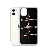 SHIFTBEAT IPHONE CASE