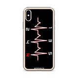 SHIFTBEAT IPHONE CASE